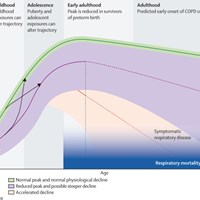 Unravelling The Respiratory Health Path Across The Lifespan For Survivors Of Preterm Birth