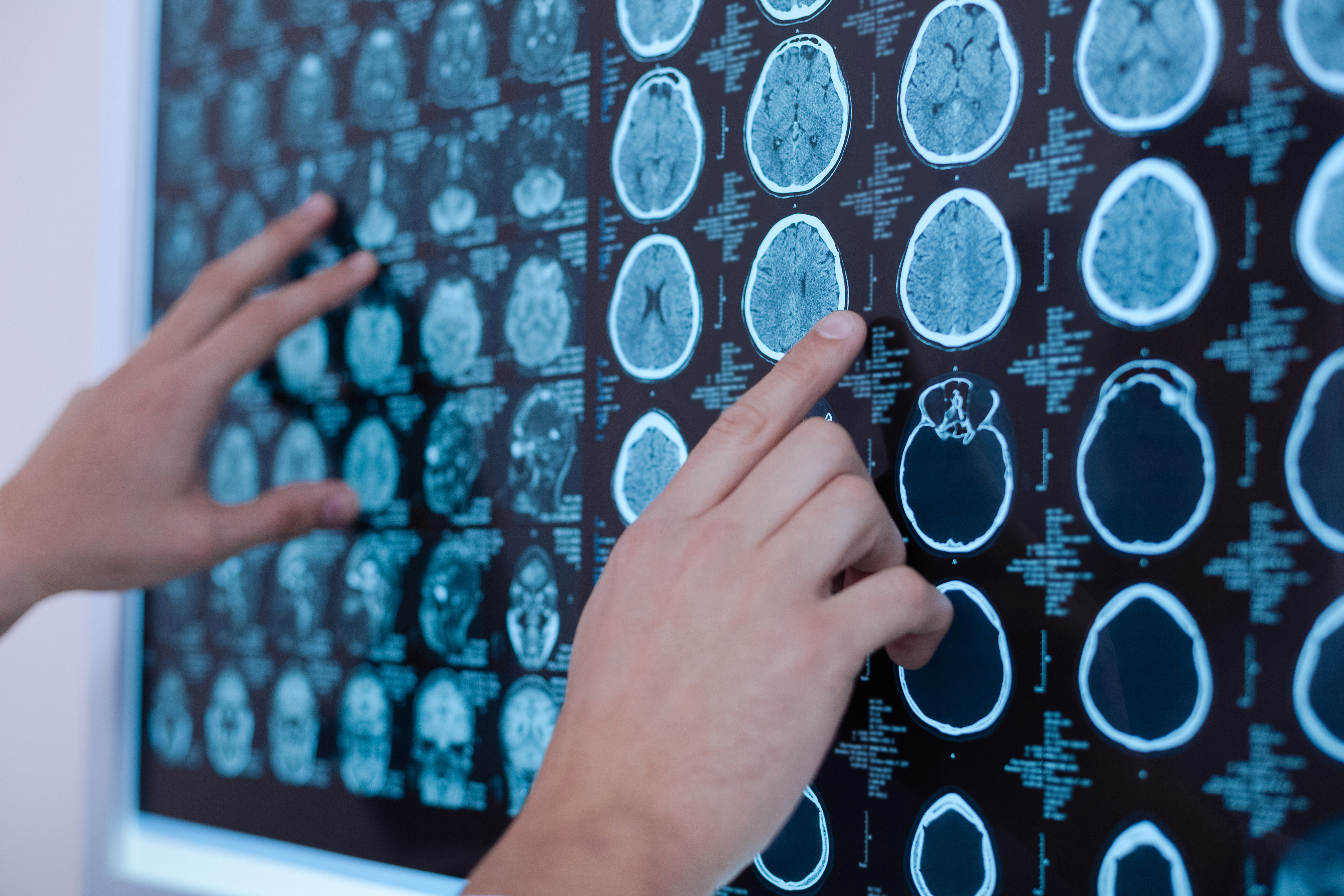 Neuromonitoring